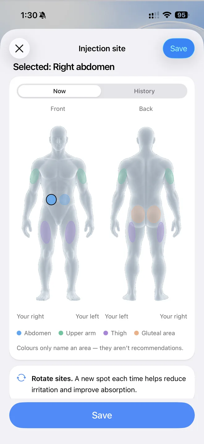 NEXA's site record: front and back body map with the selected area, Now and History tabs, and a legend that names areas only